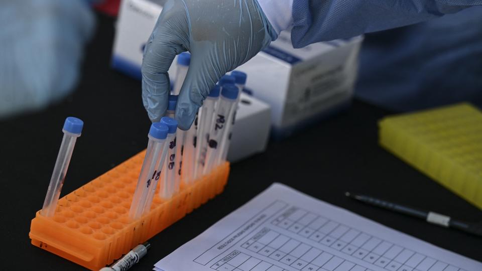 Covid-19: la France n'exige plus de test PCR pour les voyageurs en provenance de Chine