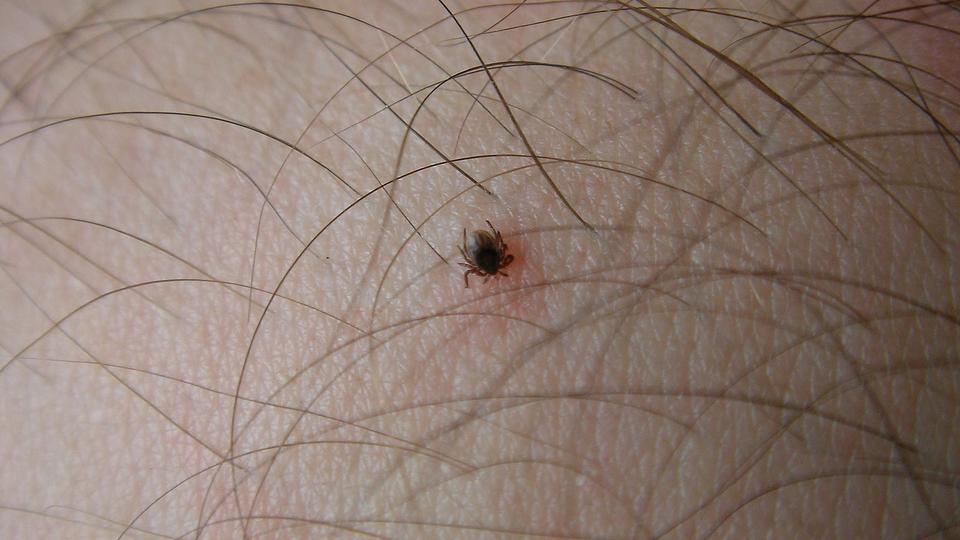 Maladie de Lyme : Ces 5 lieux où vous risquez de vous faire mordre par des tiques
