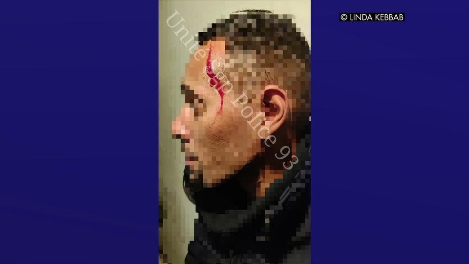 Pantin : arrêté pour exhibition, il agresse deux policiers avec un couteau qu'il avait dissimulé