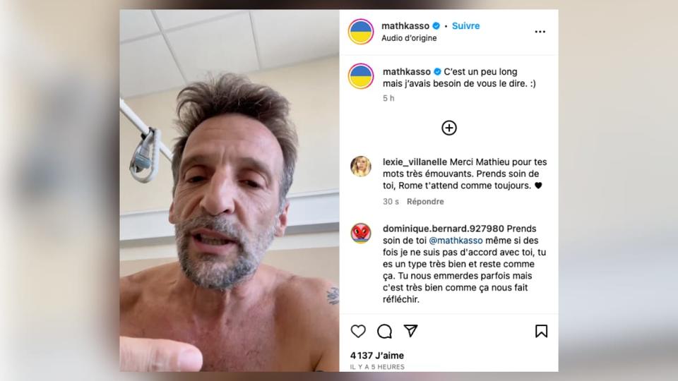 Mathieu Kassovitz : l'acteur dévoile ses blessures après son accident