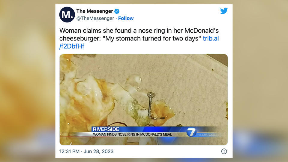 États-Unis : elle retrouve un piercing nasal usé dans son burger, le restaurant refuse de s'excuser