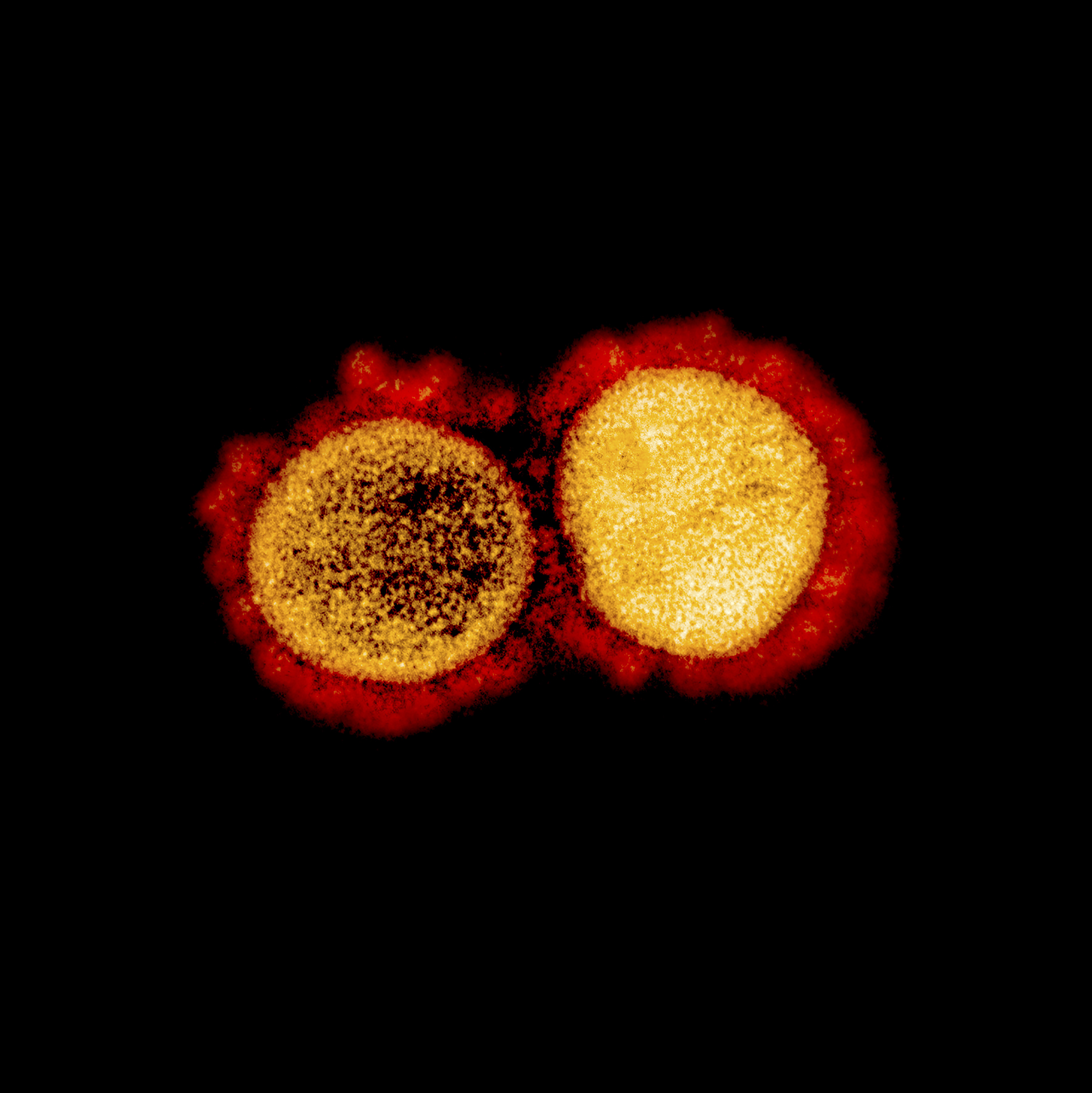 Photo of Le nouveau coronavirus utilise la deuxième «  clé  » pour infiltrer les cellules