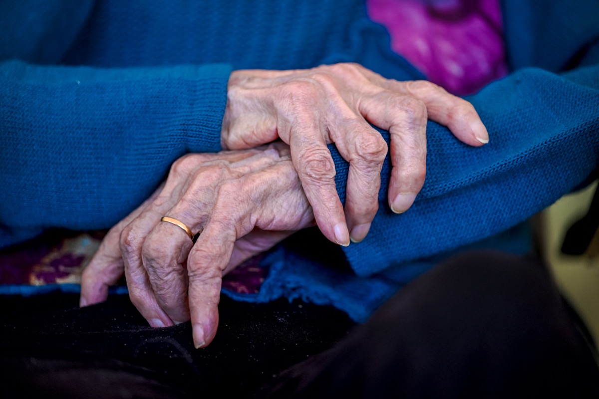 Alzheimer: alles wat u moet weten over de ontdekking van deze zeldzame mutatie die de ziekte kan vertragen