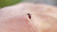 Épidémie de Dengue : quels sont les principaux symptômes qui doivent vous alerter