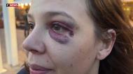 Nice : 5 personnes tabassées pour s’être défendues d’insultes sexistes, leurs agresseurs relâchés