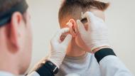 Rouen : il se plaint de bourdonnements, les médecins découvrent une araignée dans son oreille