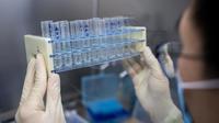 Il y a actuellement dans le monde une centaine de projets de vaccin contre le coronavirus en cours, dont une dizaine sont en phase d'essais cliniques.