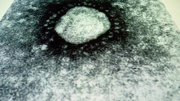 Vue au microscope du coronavirus projeté sur un écran le 9 mai 2003 lors d'une conférence à Singapour [Roslan Rahman / AFP/Archives]