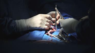 Des chirurgiens effectuent une opération [Martin Bureau / AFP/Archives]