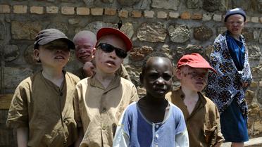 Des enfants albinos au Burundi en 2007 [Stephane de Sakutin / AFP/Archives]