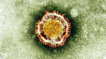 Le coronavirus chinois possède de petites excroissances sur son enveloppe, lui donnant un aspect de couronne, d’où son nom. 