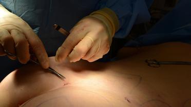 Une opération de chirurgie esthétique [Joe Klamar / AFP/Archives]