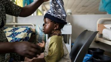 Une fillette blessée à coups de machette lors d'un massacre intercommunautaire dans le centre du Nigeria est soignée à l'hopital de Jos, le 28 juin 2018. [STEFAN HEUNIS / AFP]