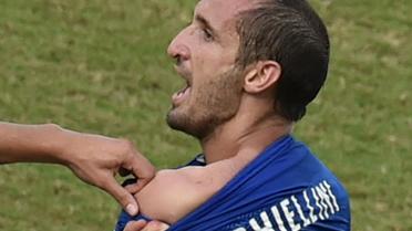 Le défenseur italien Giorgio Chiellini montre la morsure que lui a infligé l'attaquant uruguayen Luis Suarez, le 24 juin 2014 à Natal [Yasuyoshi Chiba / AFP]