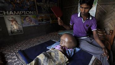 Abdul Rahman, au chevet de sa fille de 18 mois, Roona Begum, souffrant d'une hypertrophie du crâne, une maladie rare, le 15 avril 2013 près de Agartala, dans le nord-est de l'Inde [ / AFP]