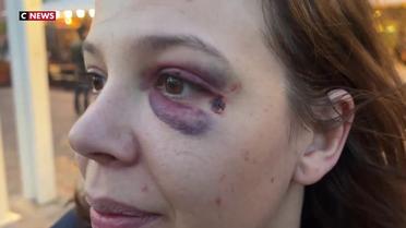 Nice : cinq personnes tabassées pour s’être défendues d’insultes sexistes