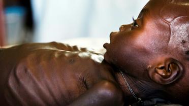 Agop Manut, un bébé de onze mois souffrant de malnutrition, est soigné dans une clinique de Médecins sans frontières, le 11 octobre 2016 à Aweil, au Soudan du Sud [ALBERT GONZALEZ FARRAN / AFP/Archives]