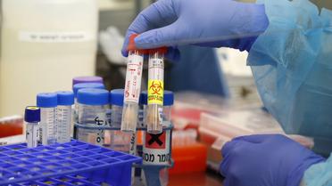 Un lot provenant d'un laboratoire Luxembourgeois aurait été contaminé par le coronavirus lui-même.