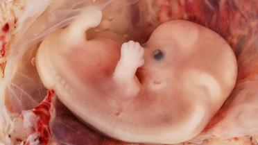 Un embryon humain âgé de neuf semaines