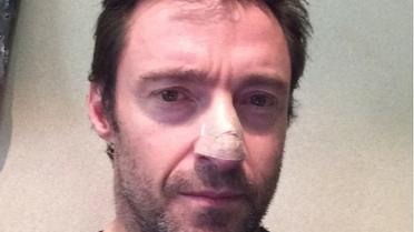 L'acteur de 45 ans a annoncé se soigner d'un cancer de la peau en postant une photo sur Instagram