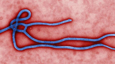 Le virus Ebola au microscope.