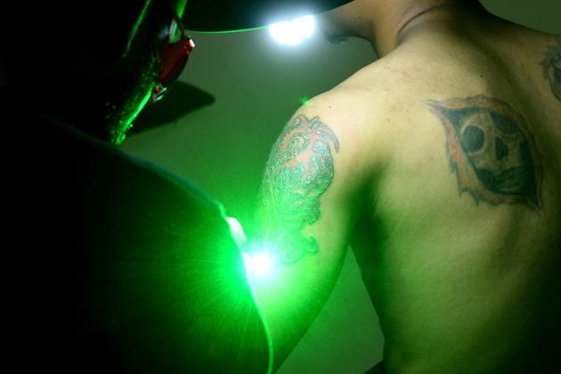 Sandi Widodo travaille sur un client musulman qui souhaite effacer ses tatouages, le 18 avril 2018 à Jakarta, en Indonésie [GOH Chai Hin / AFP]