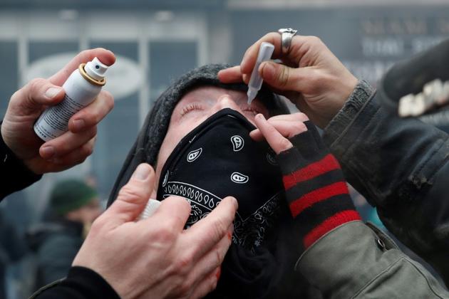 Du sérum physiologique contre les lacrymogènes, lors de la manifestation à Paris le 5 décembre 2019 [Zakaria ABDELKAFI / AFP]