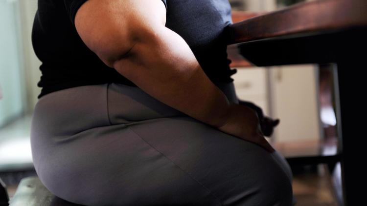 Une femme souffrant d'obésité [Vanderlei Almeida / AFP/Archives]