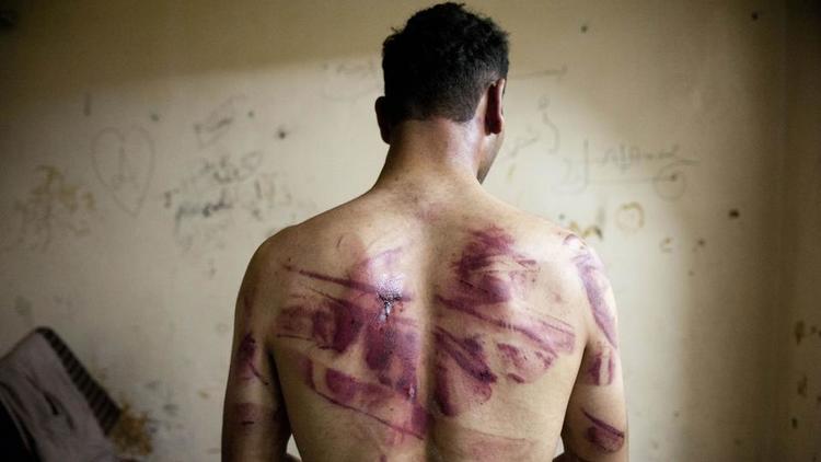 Le principal suspect, Anwar Raslan, est accusé d'avoir dirigé une prison en Syrie où «au moins 4.000 personnes» ont subi des actes de torture entre 2011 et 2012. 