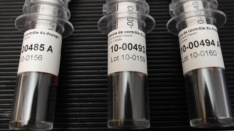 Echantillons de sang sur le point d'être analysés dans un laboratoire des Jeux d'hiver de Vancouver le 9 février 2010 à Richmond [Robyn Beck / AFP/Archives]