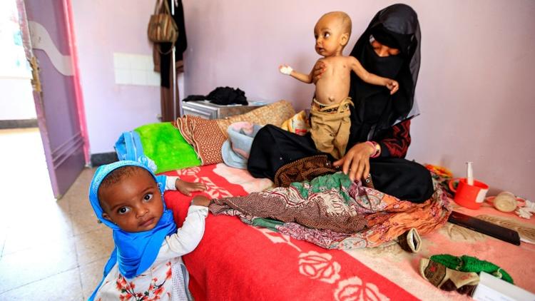 Des enfants souffrant de malnutrition dans un hôpital de Sanaa, au Yémen, le 22 juin 2019 [Mohammed HUWAIS / AFP/Archives]