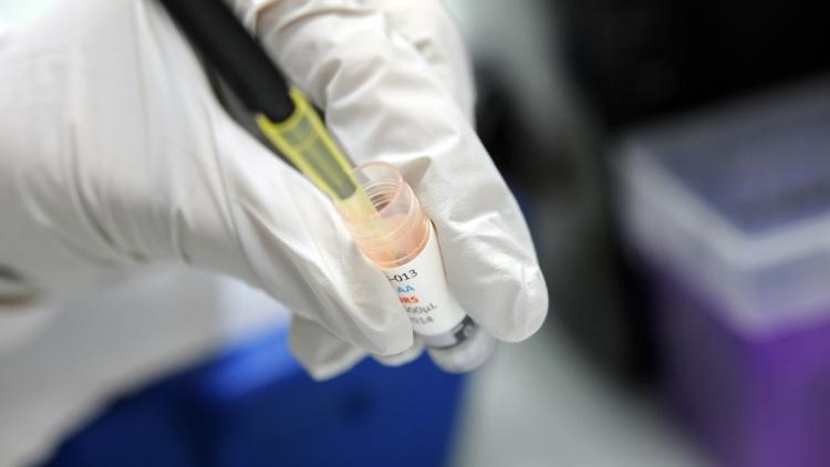 Les cellules cancéreuses perdent de petits fragments d'ADN en circulant dans le sang et ceux-ci peuvent être collectés et analysés en laboratoire pour décider de la thérapie à suivre [FRED TANNEAU / AFP/Archives]