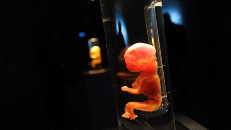 Les maladies génétiques pourront désormais être repérées avant même la fécondation du foetus